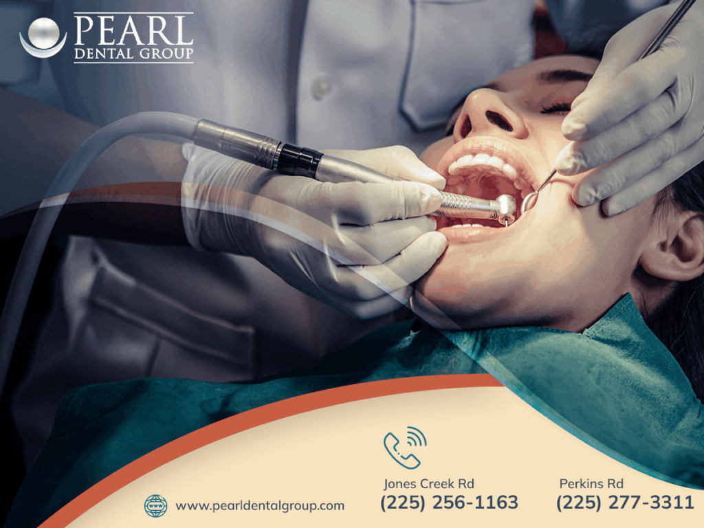 All-on-4 dental implants Baton Rouge
