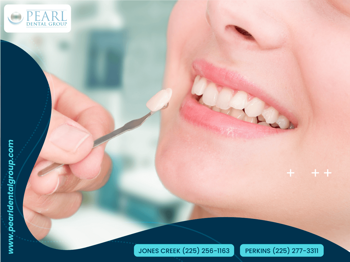 Cosmetic dentist Baton Rouge