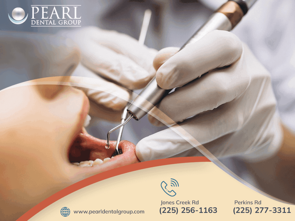 Dental Implants Baton Rouge