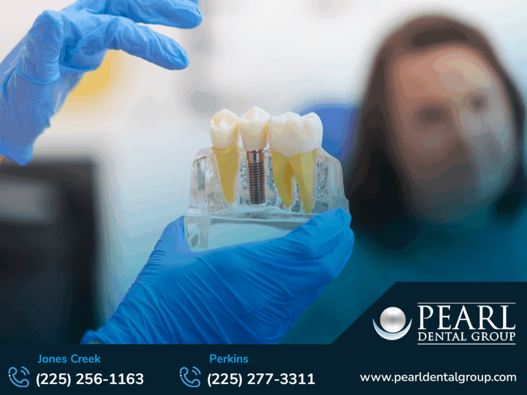 Dental Implants Baton Rouge