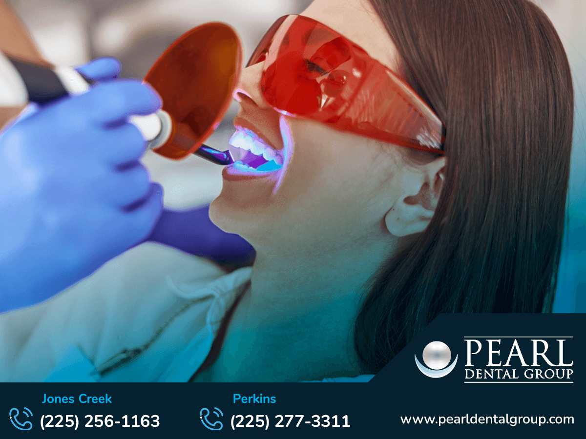 Porcelain veneers Baton Rouge