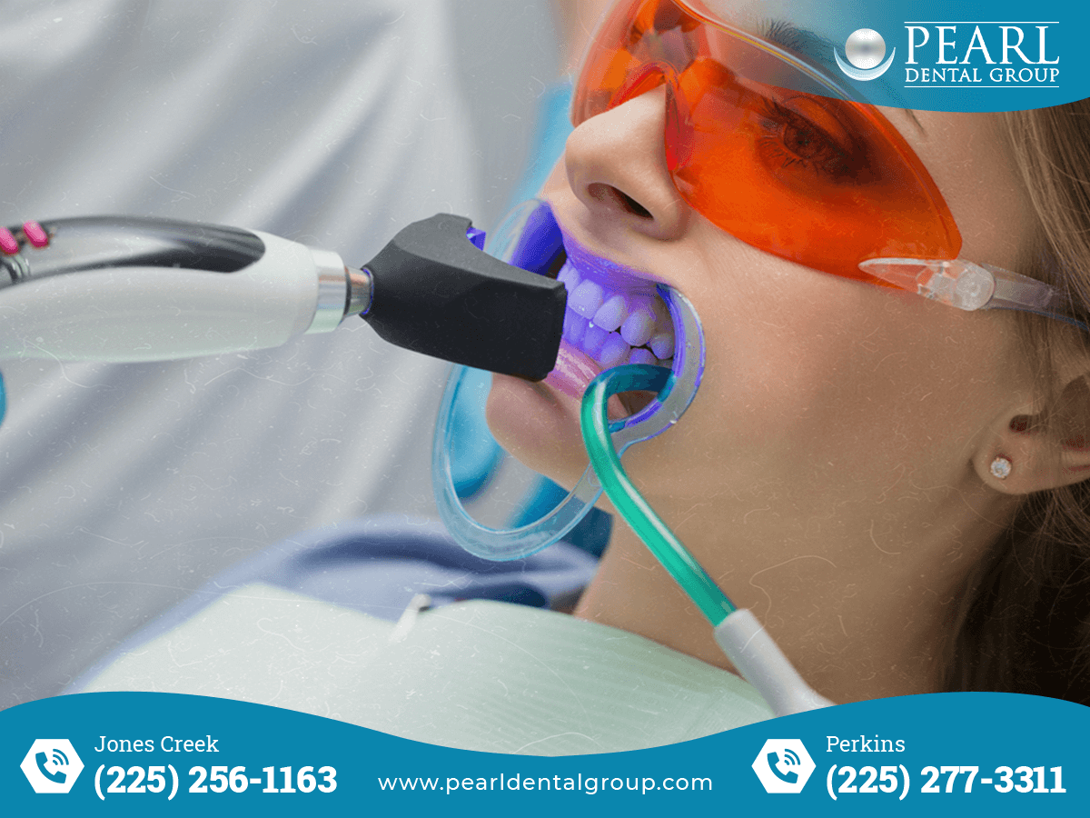 Emergency Dentist in Baton Rouge