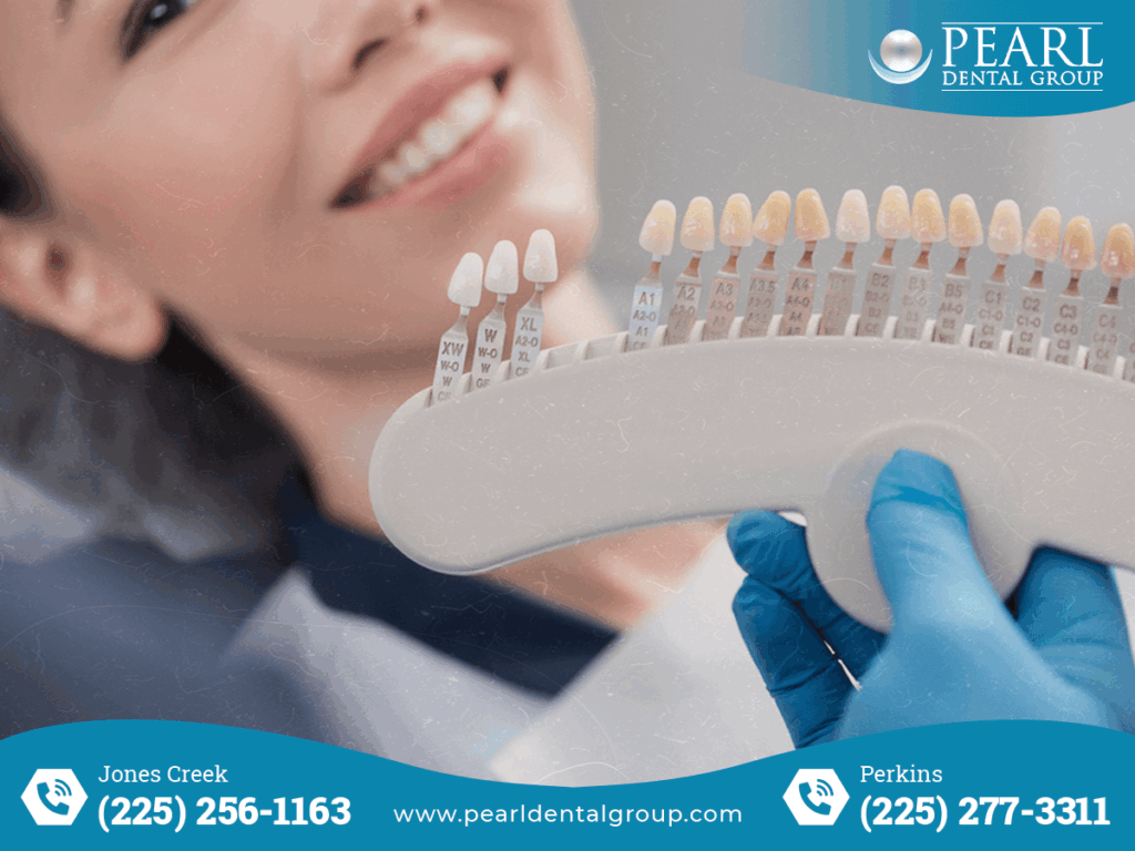 Porcelain veneers Baton Rouge