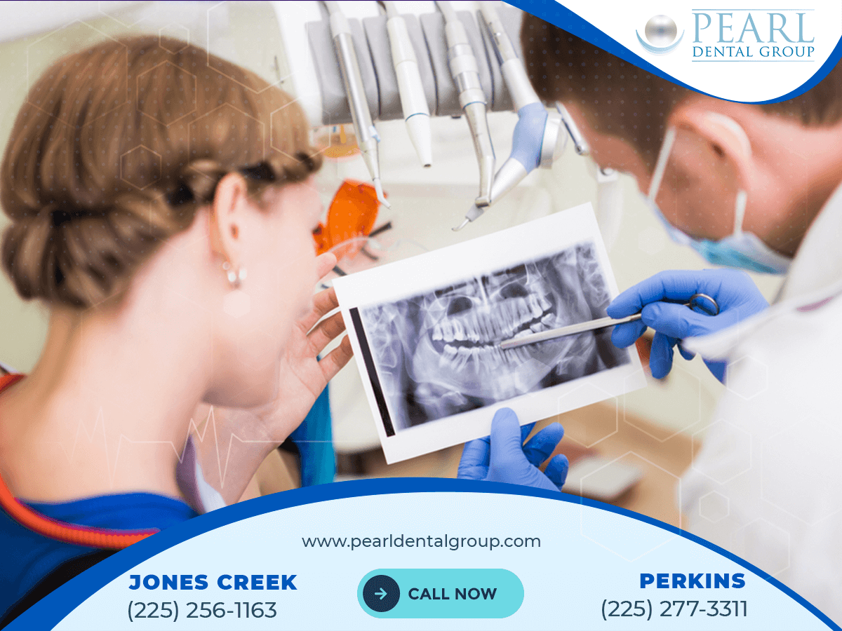 Dental Implants Baton Rouge