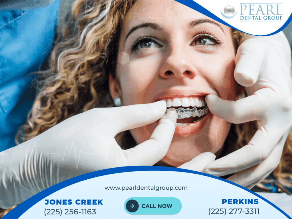Porcelain veneers Baton Rouge
