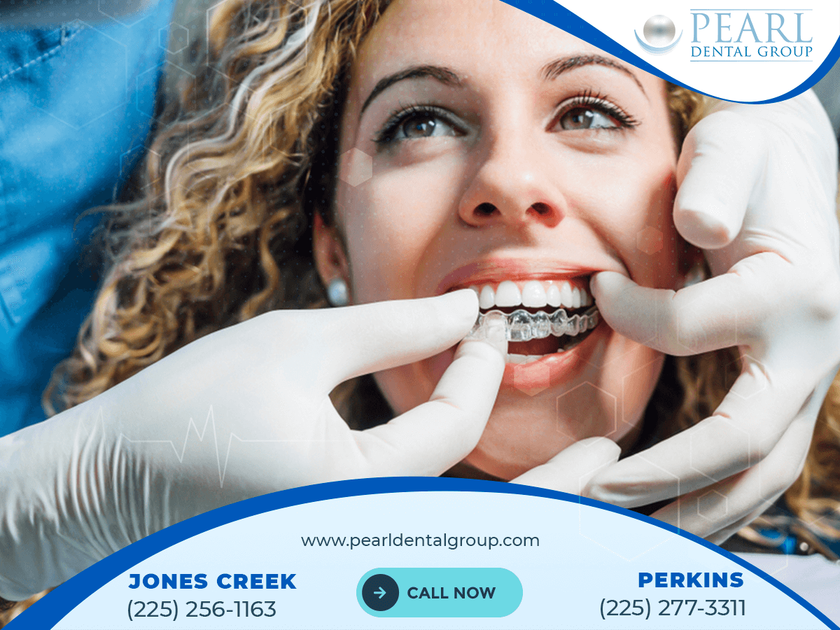 Porcelain veneers Baton Rouge
