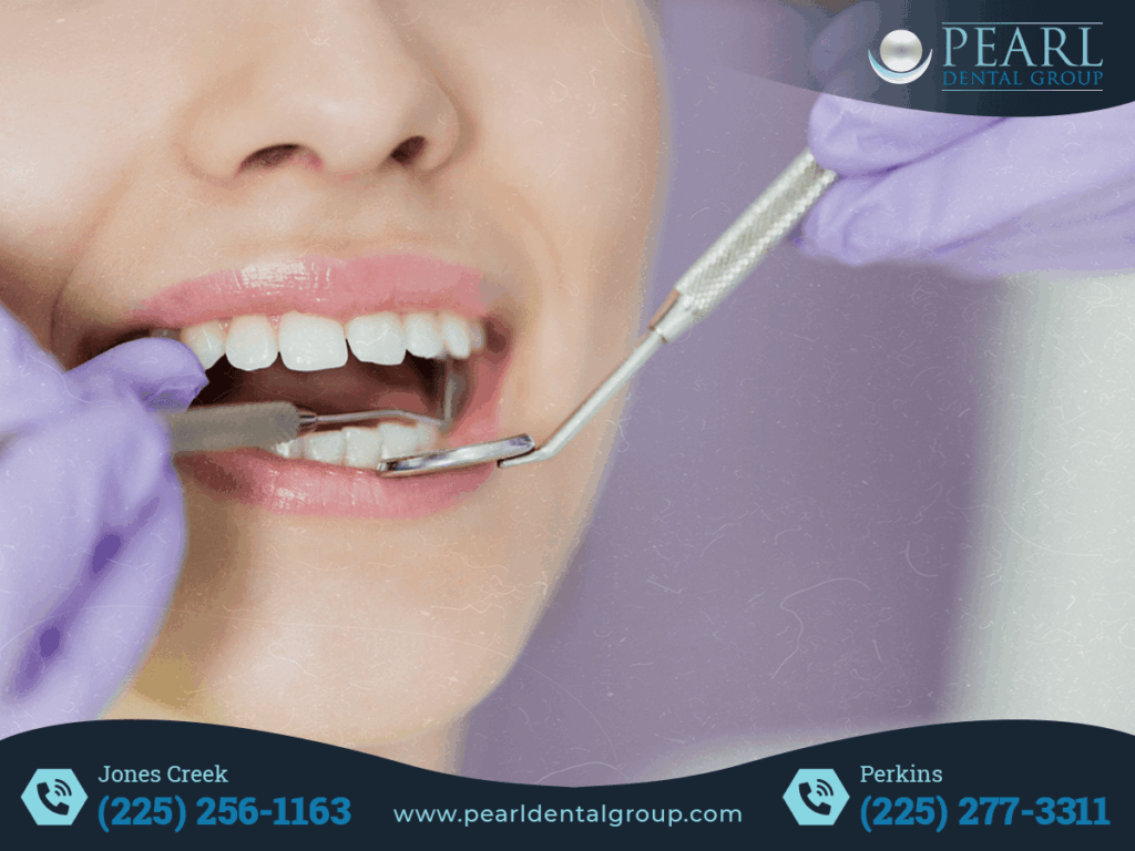 Emergency Dentist in Baton Rouge