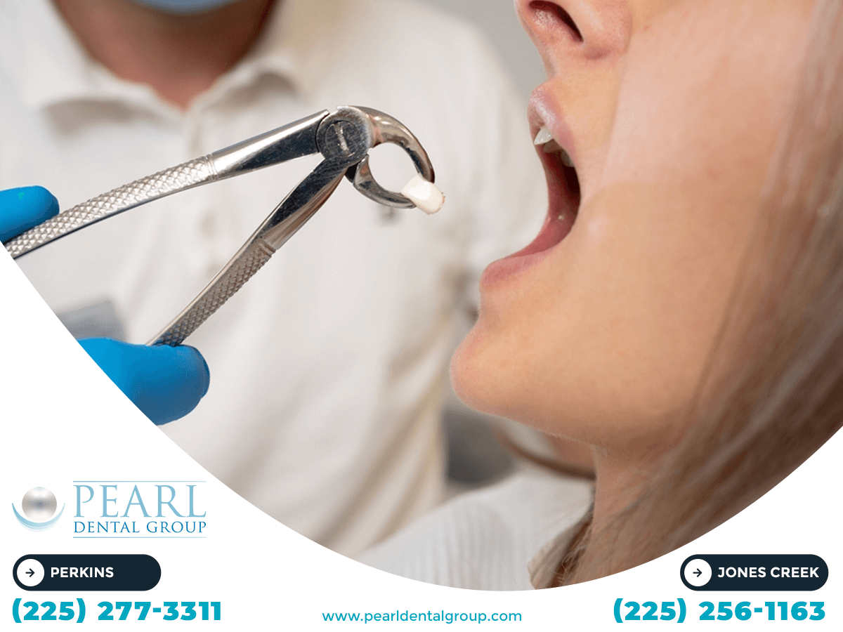 affordable dentistry in Baton Rouge