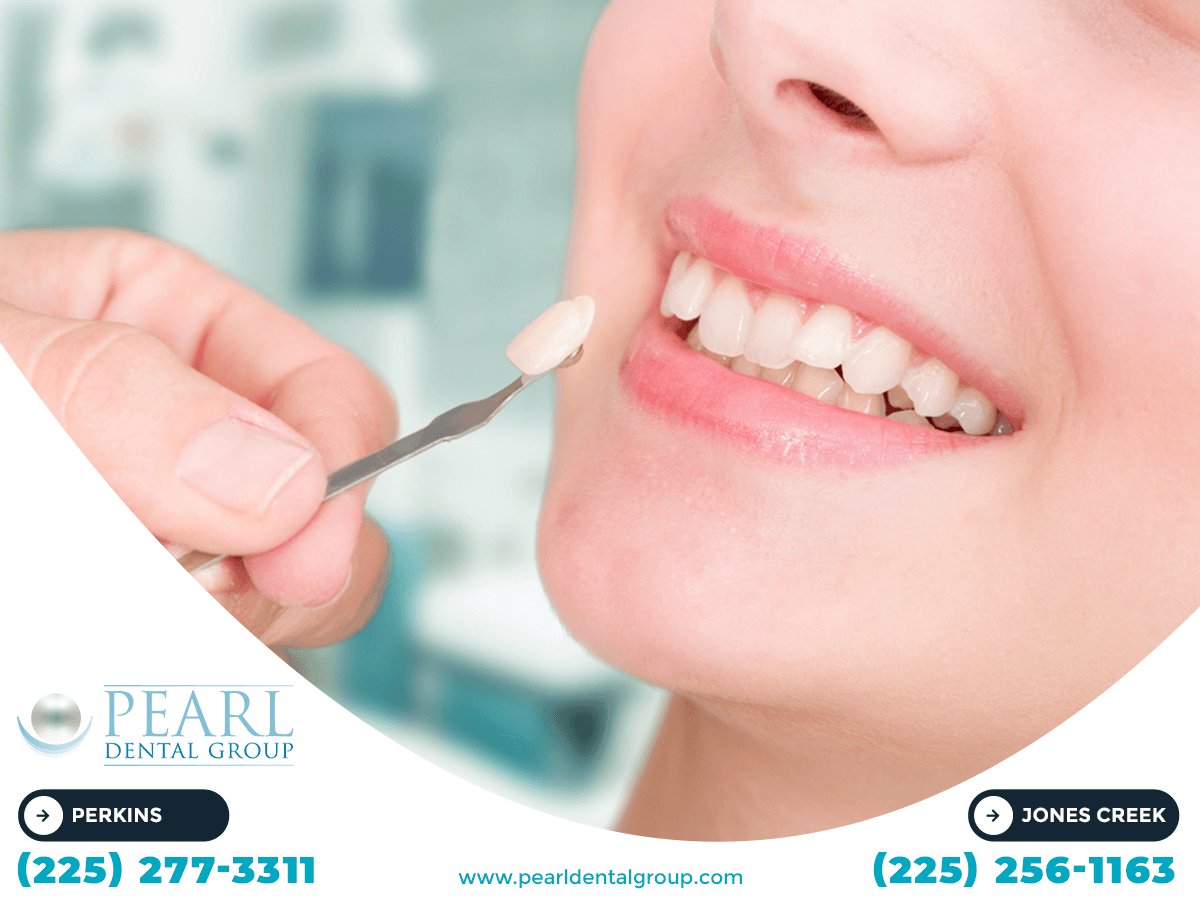 Best Cosmetic Dentist in Baton Rouge