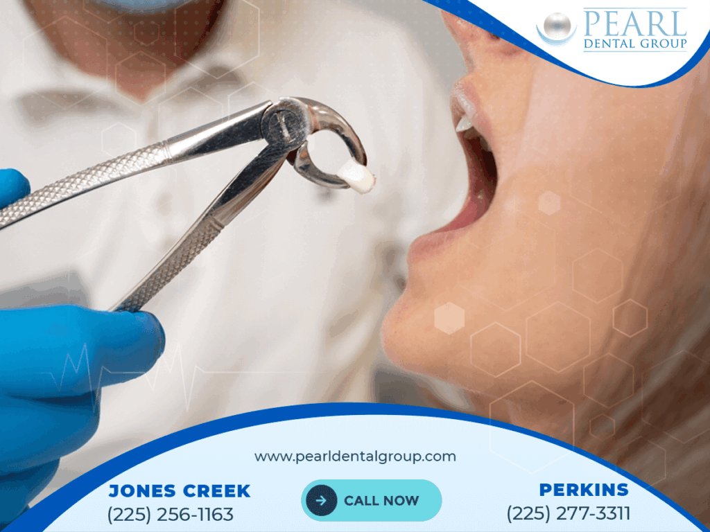 Best Cosmetic Dentist in Baton Rouge