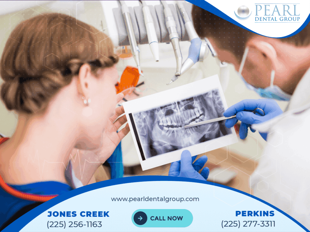 Best Dental Implants in Baton Rouge