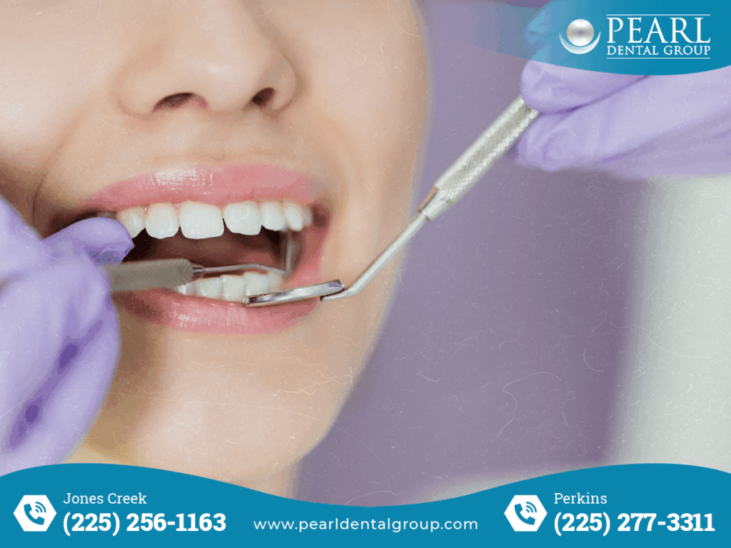 affordable dentist in Baton Rouge