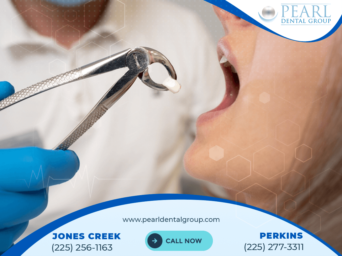 cosmetic dentist Baton Rouge