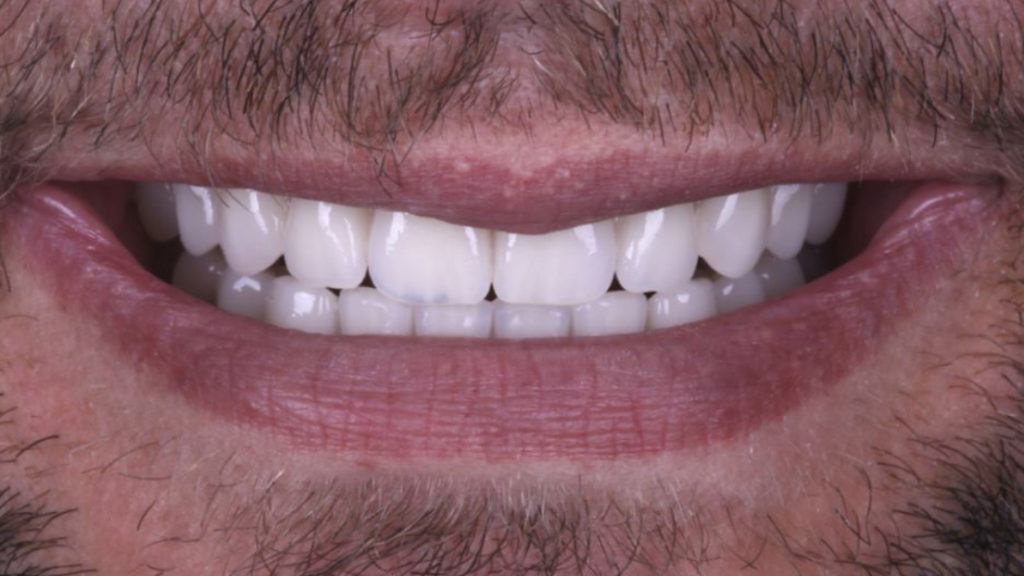 Reliable Emergency Dentist in Baton Rouge