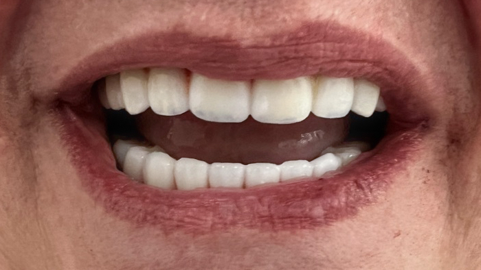 Sedation Dentistry in Baton Rouge