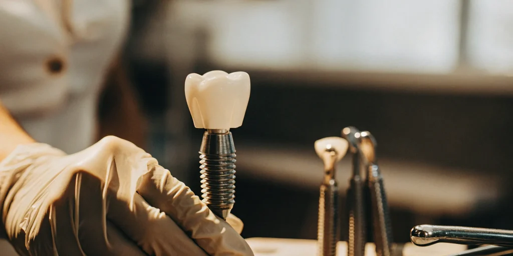 Single tooth implant cost.