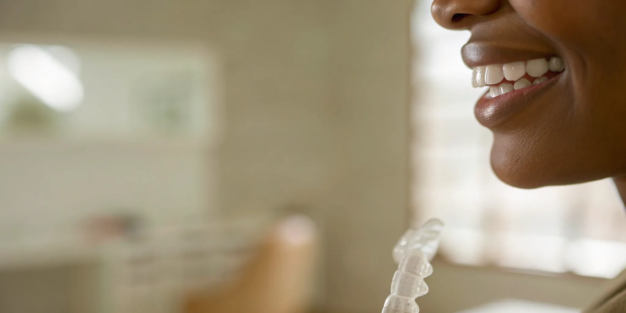 Straight, white teeth with Invisalign clear aligners.