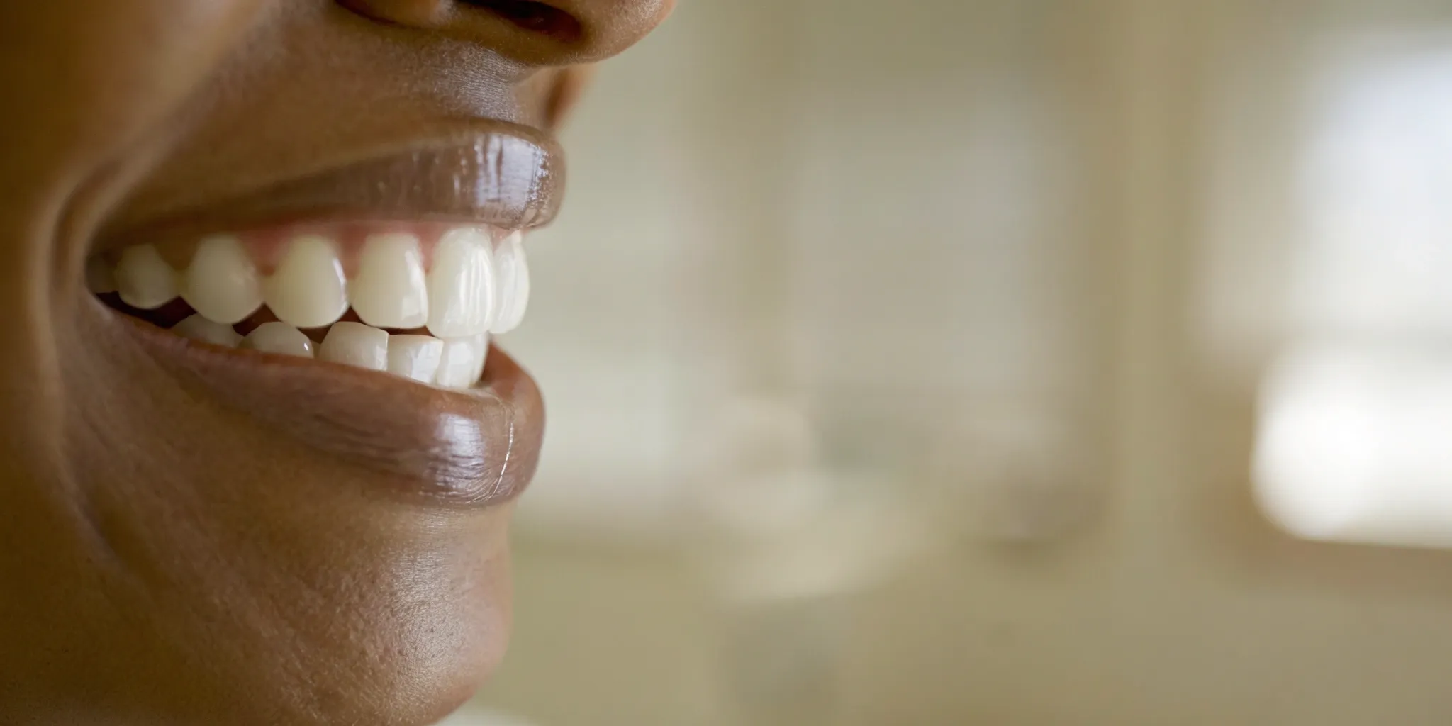 Smiling patient with All-on-6 dental implants.