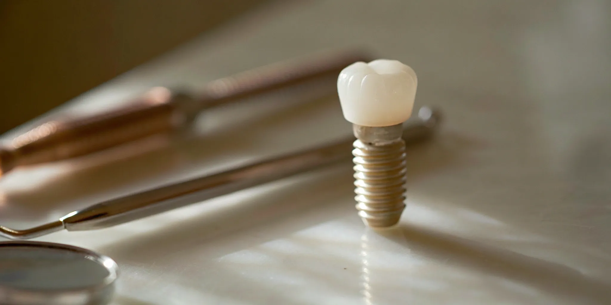 A dental implant model representing the cost of full mouth dental implants without insurance.