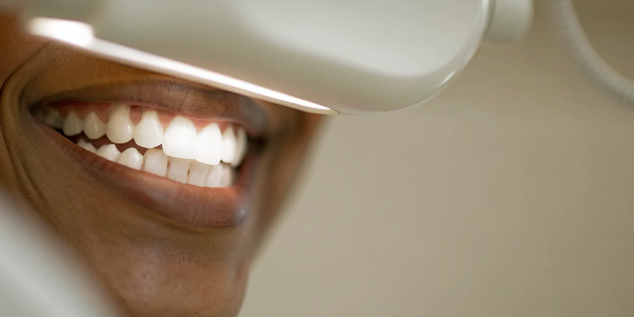 Close-up of a smile during a professional teeth whitening procedure.