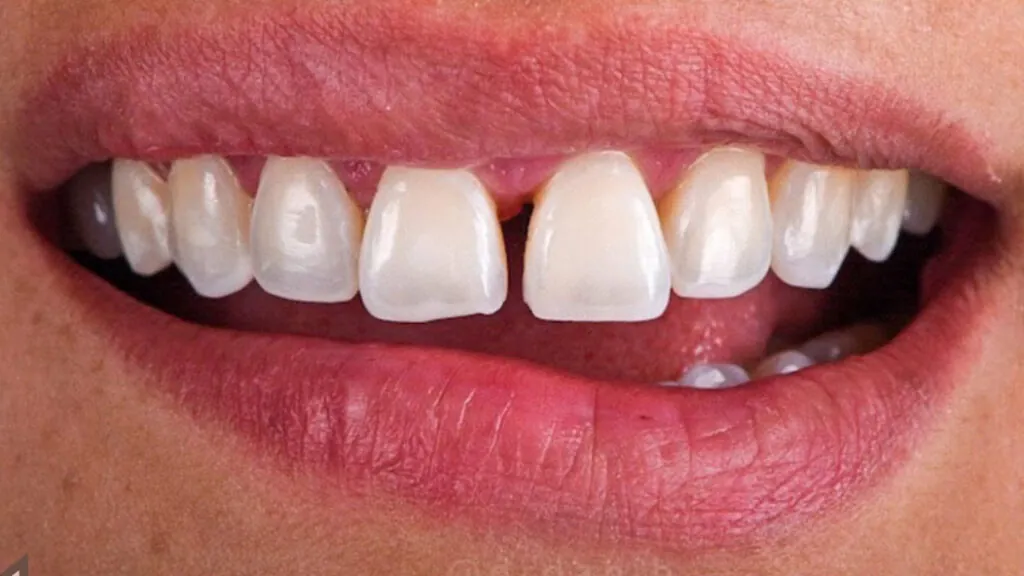 20230611_132433000_iOS-1024x576