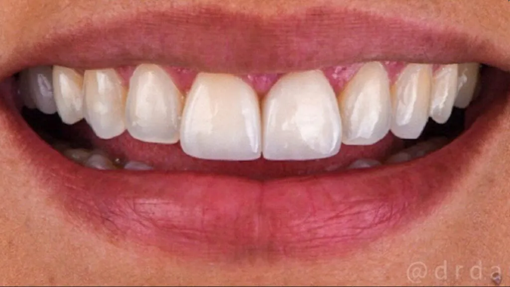 20230611_132513000_iOS-1024x576