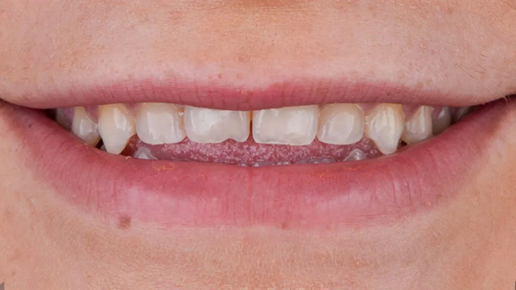 20230611_133036000_iOS-1024x576