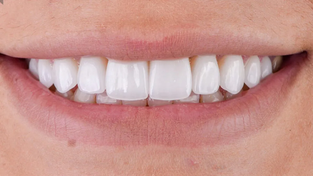 20230611_133057000_iOS-1024x576