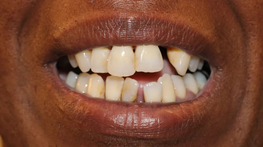 401-Aimee-Forrest_230705_071028_2001-1024x576