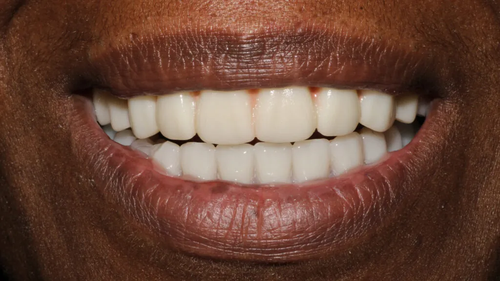 401-Aimee-Forrest_231205_160138_3C73-1024x576 (1)