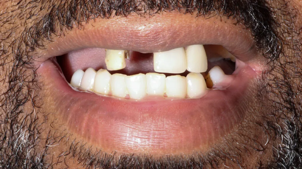 5074-Henry-Logan_221221_083112_566B-1024x576