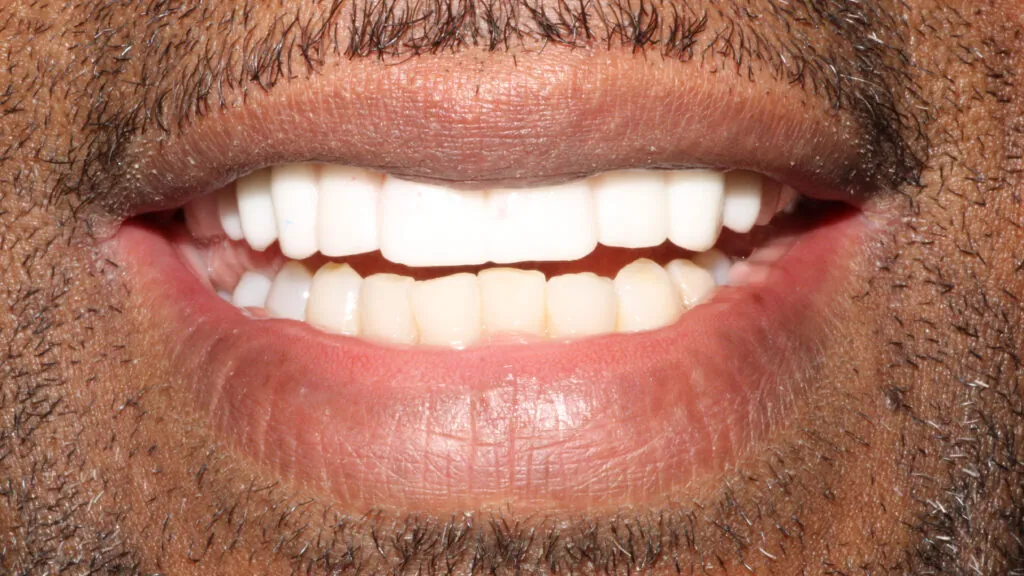 5074-Henry-Logan_230421_152126_8280-1024x576