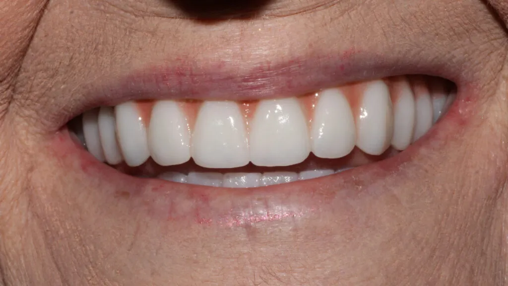 7384-Cathie-Moody_231121_192320_DAFA-1024x576 (1)