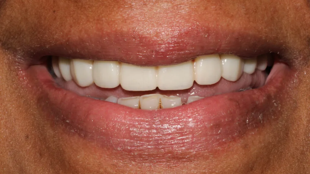 8130-Aiesha-Clay_231205_115656_3C68-1024x576 (2)