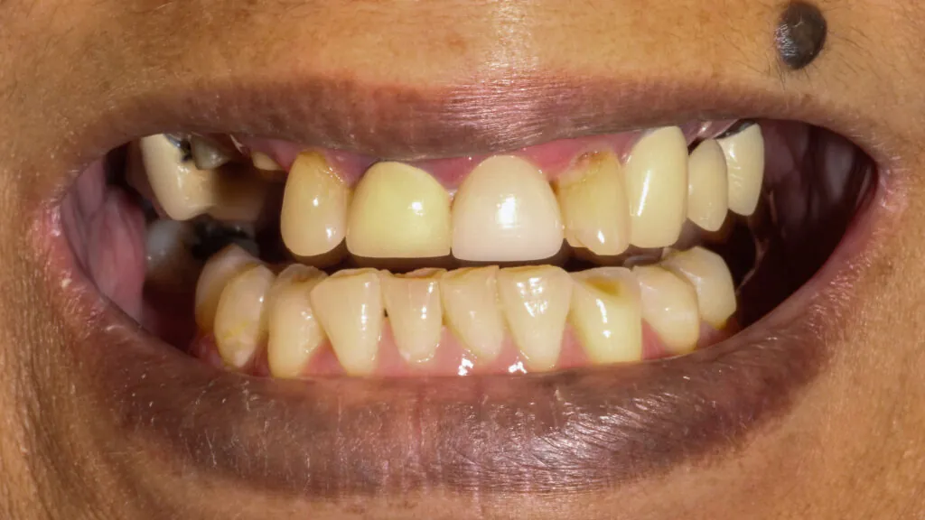 8149-Gloria-Shipley_230803_155228_E172-1024x576 (1)