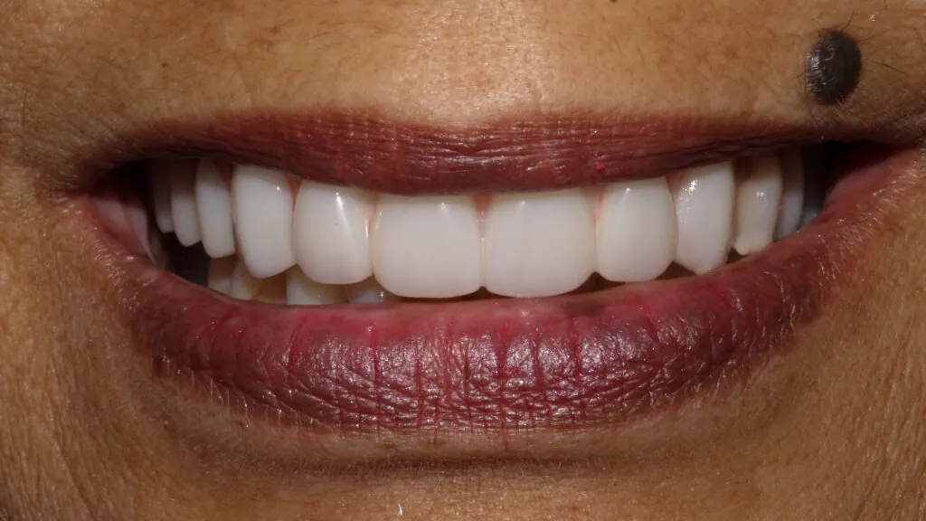 8149-Gloria-Shipley_231122_181010_3C8D-1024x576 (1)