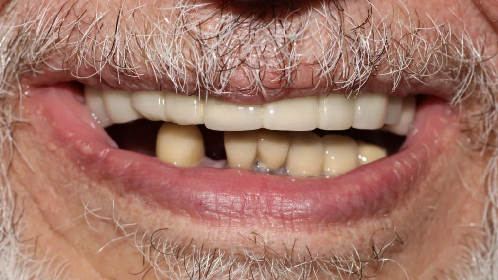 9705-Steve-Nordenstrom_231107_171348_D670-1024x576 (1)