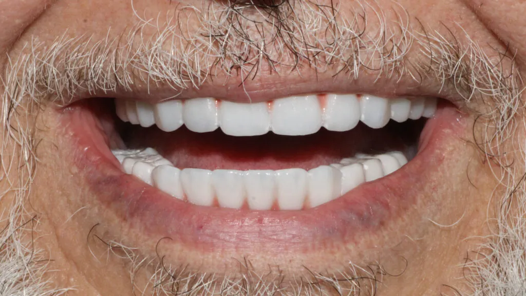 9705-Steve-Nordenstrom_240404_161254_107AB-1024x576