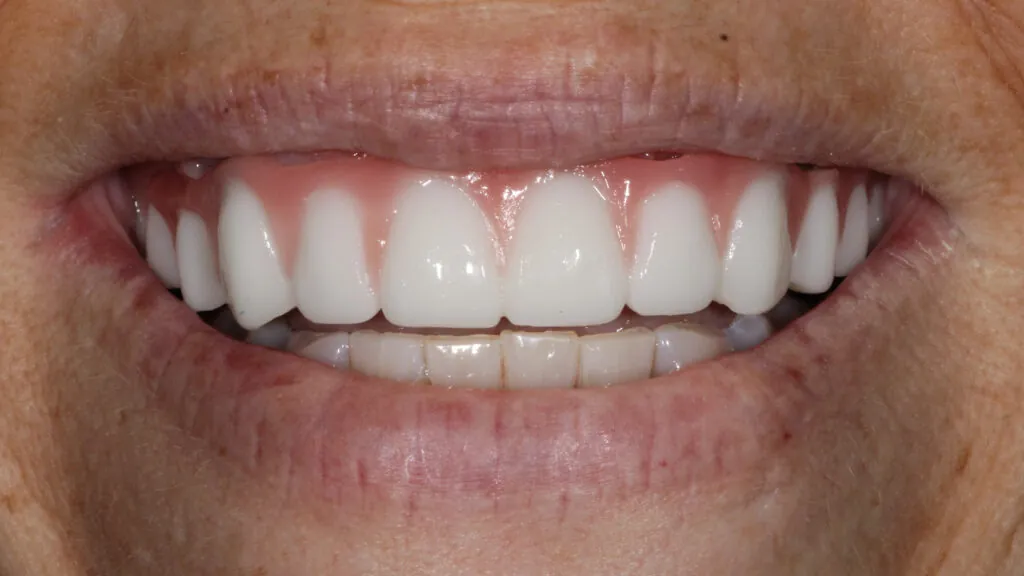 9899-Kristy-Hubbard_240808_183636_14B9F-1024x576 (1)