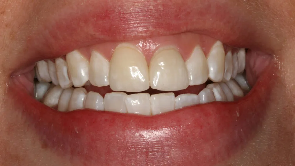 IMG_0965cropped-1024x576