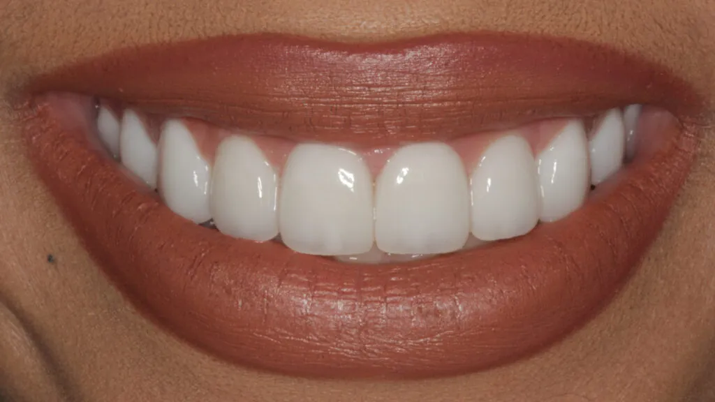 after-smile-1024x576